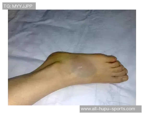 方硕脚踝90度扭伤!两年无休的他还是倒下了 方硕脚踝90度扭伤!两年无休的他还是倒下了